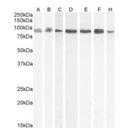 abx431357 (0.03 µg/ml) staining of A431 (A), HEK293 (B), Jurkat (C), (0.01ug/ml) Daudi (D), HeLa (E) and (0.1 µg/ml) Kelly (F) and KNRK (G) cell lysate (35 µg protein in RIPA buffer). Detected by chemiluminescence..