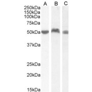 abx431359 (0.05 µg/ml) staining of Human PBM (A), (0.03 µg/ml) Lymph Node (B) and Tonsil (C) lysate (35 µg protein in RIPA buffer). Detected by chemiluminescence.