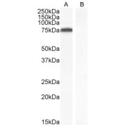 abx431365 (1 µg/ml) staining of Jurkat nuclear cell lysate (A) and negative control Human parathyroid gland (B) (35 µg protein in RIPA buffer). Detected by chemiluminescence.