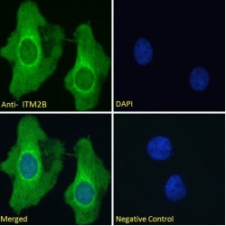 Integral Membrane Protein 2B (ITM2B) Antibody