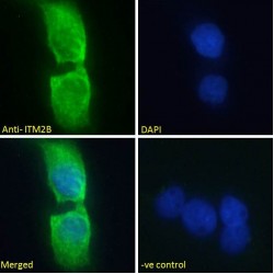 Integral Membrane Protein 2B (ITM2B) Antibody