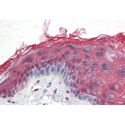 Inositol 1,4,5-Trisphosphate Receptor Type 2 (ITPR2) Antibody