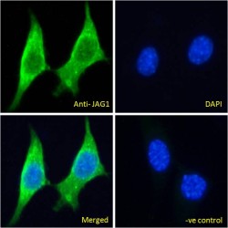 Protein Jagged-1 (JAG1) Antibody