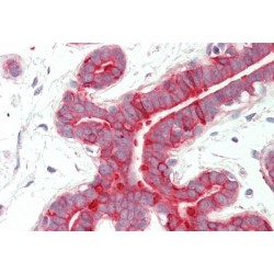 keratin 18 (KRT18) Antibody