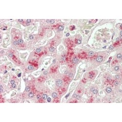 Phosphatidylcholine-Sterol Acyltransferase (LCAT) Antibody