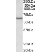 abx431381 (0.1 µg/ml) staining of Human Thymus lysate (35 µg protein in RIPA buffer). Primary incubation was 1 hour. Detected by chemiluminescence.