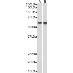 Proto-Oncogene Tyrosine-Protein Kinase LCK (LCK) Antibody