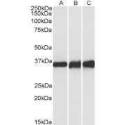 abx431382 (0.1 µg/ml) staining of Human (A), Mouse (B) and Rat (C) Heart lysates (35 µg protein in RIPA buffer). Primary incubation was 1 hour. Detected by chemiluminescence.