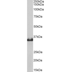 Lactate Dehydrogenase B (LDHB) Antibody