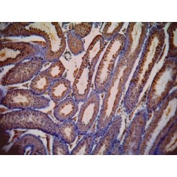 Lactate Dehydrogenase C (LDHC) Antibody