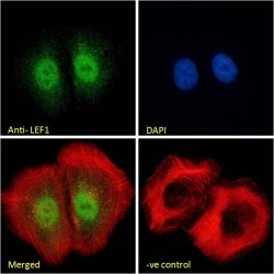 Lymphoid Enhancer Binding Factor 1 (LEF1) Antibody