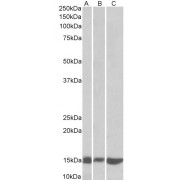 abx431386 (0.1 µg/ml) staining of Mouse (A) and Rat (B) Pancreas lysates and NIH3T3 (C) lysate (35 µg protein in RIPA buffer). Primary incubation was 1 hour. Detected by chemiluminescence.