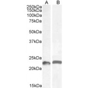 abx431389 (0.5 µg/ml) staining of Mouse (A) and (1 µg/ml) Rat (B) Colon lysate (35 µg protein in RIPA buffer). Detected by chemiluminescence.