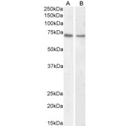 abx431391 (1 µg/ml) staining of HeLa (A) and Jurkat (B) nuclear lysate (35 µg protein in RIPA buffer). Primary incubation was 1 hour. Detected by chemiluminescence.