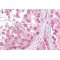 LIM Homeobox Transcription Factor 1 Beta (LMX1B) Antibody