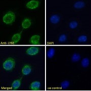 abx431401 Immunofluorescence analysis of paraformaldehyde fixed NIH3T3 cells, permeabilized with 0.15% Triton. Primary incubation 1hr (10 µg/ml) followed by AF488 secondary antibody (2 µg/ml), showing membrane staining. The nuclear stain is DAPI (blue). Negative control: Unimmunized goat IgG (10 µg/ml) followed by AF488 secondary antibody (2 µg/ml).
