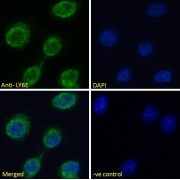 abx431401 Immunofluorescence analysis of paraformaldehyde fixed NIH3T3 cells, permeabilized with 0.15% Triton. Primary incubation 1hr (10 µg/ml) followed by AF488 secondary antibody (2 µg/ml), showing membrane staining. The nuclear stain is DAPI (blue). Negative control: Unimmunized goat IgG (10 µg/ml) followed by AF488 secondary antibody (2 µg/ml).