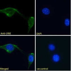 Lymphocyte Antigen 6 Complex Locus E (LY6E) Antibody