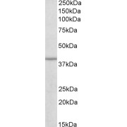abx431403 (0.3 µg/ml) staining of Human Skeletal muscle lysate (35 µg protein in RIPA buffer). Primary incubation was 1 hour. Detected by chemiluminescence.