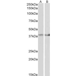 Isocitrate Dehydrogenase 3 (NAD(+)) Beta (IDH3B) Antibody