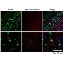 Zinc/RING Finger Protein 1 (ZNRF1) Antibody