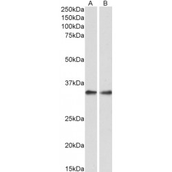 Protein Phosphatase 4 Catalytic Subunit (PPP4C) Antibody