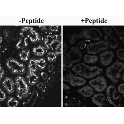 Solute Carrier Family 26 Member 6 (SLC26A6) Antibody