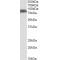 Solute Carrier Family 26 Member 6 (SLC26A6) Antibody