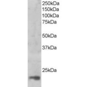 abx431413 (1 µg/ml) staining of nuclear HeLa lysate (35 µg protein in RIPA buffer). Primary incubation was 1 hour. Detected by chemiluminescence.