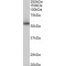 Nitrogen Permease Regulator 3-Like Protein (Nprl3) Antibody