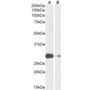 abx431419 (1 µg/ml) staining of Mouse (A) and Rat (B) Lung lysate (35 µg protein in RIPA buffer). Primary incubation was 1 hour. Detected by chemiluminescence