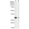 Achaete-Scute Homolog 1 (ASCL1) Antibody
