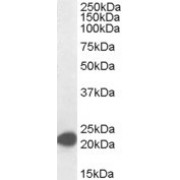abx431420 (0.01 µg/ml) staining of Jurkat lysate (35 µg protein in RIPA buffer). Detected by chemiluminescence.