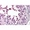 Protein Inhibitor of Activated STAT2 (PIAS2) Antibody