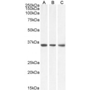 abx431434 (0.1 µg/ml) staining of HeLa (A), HepG2 (B) and NIH3T3 (C) lysate (35 µg protein in RIPA buffer). Primary incubation was 1 hour. Detected by chemiluminescence.