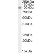 abx431451 (0.1 µg/ml) staining of Human Kidney lysate (35 µg protein in RIPA buffer). Primary incubation was 1 hour. Detected by chemiluminescence.