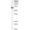Neurofilament, Light Polypeptide (NEFL) Antibody