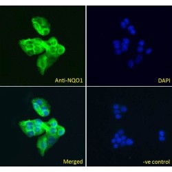 NAD(P)H Dehydrogenase, Quinone 1 (NQO1) Antibody