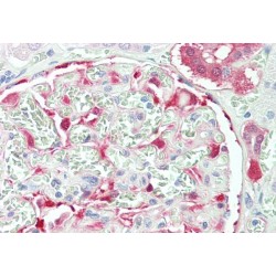 NAD(P)H Dehydrogenase, Quinone 1 (NQO1) Antibody