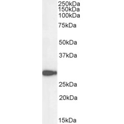NAD(P)H Dehydrogenase, Quinone 1 (NQO1) Antibody