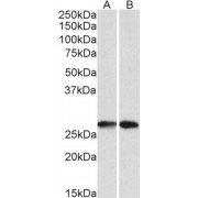 abx431457 (0.1 µg/ml) staining of A549 (A) and HeLA (B) lysates (35 µg protein in RIPA buffer). Primary incubation was 1 hour. Detected by chemiluminescence.