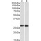 Nicotinamide N-Methyltransferase (NNMT) Antibody