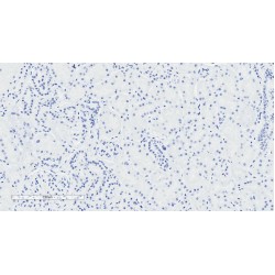 Natriuretic Peptide Receptor 3 (NPR3) Antibody