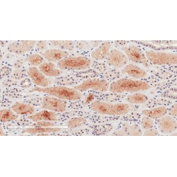 Natriuretic Peptide Receptor 3 (NPR3) Antibody