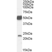 abx431469 (0.1 µg/ml) staining of Mouse Brain lysate (35 µg protein in RIPA buffer). Primary incubation was 1 hour. Detected by chemiluminescence.