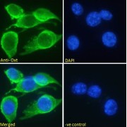 abx431480 Immunofluorescence analysis of paraformaldehyde fixed NIH3T3 cells, permeabilized with 0.15% Triton. Primary incubation 1hr (10 µg/ml) followed by AF488 secondary antibody (2 µg/ml), showing cytoplasmic and membrane staining. The nuclear stain is DAPI (blue). Negative control: Unimmunized goat IgG (10 µg/ml) followed by AF488 secondary antibody (2 µg/ml).