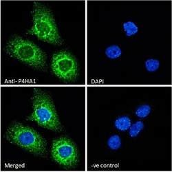 Prolyl 4-Hydroxylase Subunit Alpha-1 (P4HA1) Antibody
