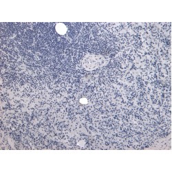 Prolyl 4-Hydroxylase Subunit Alpha-1 (P4HA1) Antibody