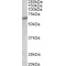 Serine/threonine-Protein Kinase PAK 1 (PAK1) Antibody