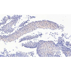Paired Box 3 (PAX3) Antibody